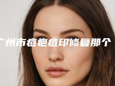 广州市痘疤痘印修复那个整形医院比较好(广州市痘疤痘印修复医院上榜清单综合实力前十位哪个效果好)